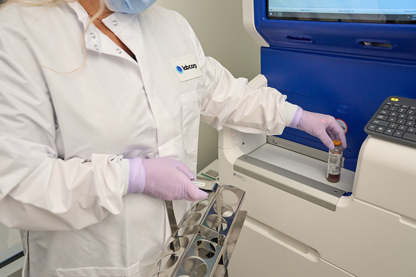 A woman in a lab coat and gloves holds a test tube, symbolizing the journey of blood samples in a laboratory.