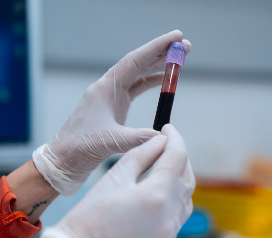 Blood sample collected for genetic testing to help identify inherited health risks and provide personalized health insights.